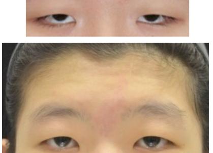 上海頸脖紋脂肪填充醫(yī)療美容機構2023年排行榜前10強