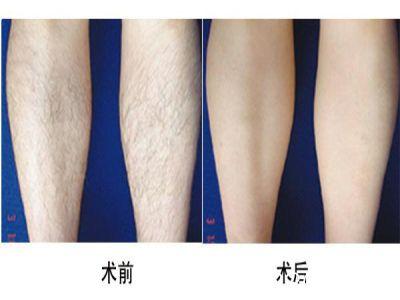 上海御顏醫(yī)療美容門診部的醫(yī)生技術(shù)真的靠譜嗎？他們的技術(shù)點(diǎn)評如何？