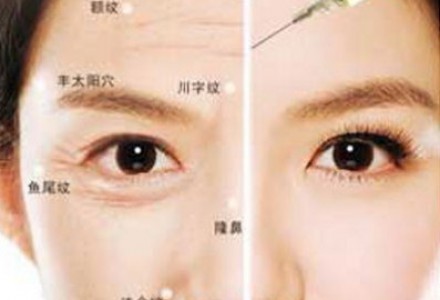 合肥哪家醫(yī)院做botox祛除魚尾紋效果較好？2023年很受歡迎的十家醫(yī)療整形醫(yī)院在此亮相！
