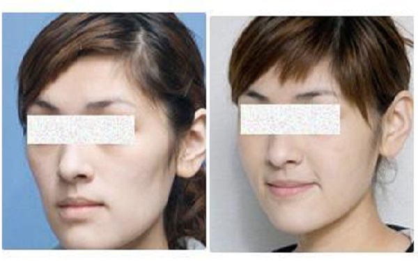 2023年評(píng)分前幾重慶激光修復(fù)疤痕優(yōu)質(zhì)整形醫(yī)院名單揭秘！