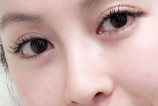 邢臺哪家醫(yī)院可以安全有效去除痦子？邢臺仁愛醫(yī)院整形科值得選擇