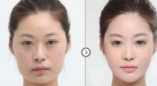 淄博眼袋整形哪家醫(yī)院口碑好？權(quán)威整形醫(yī)院排行榜揭曉