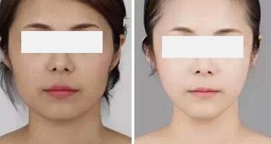 西安壹加壹醫(yī)療美容：口碑體驗(yàn)與價(jià)格公開