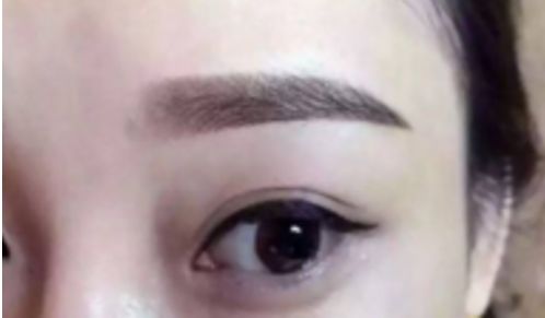 熱門(mén)選項(xiàng)！烏魯木齊哪家雙眼皮整形醫(yī)院口碑好？