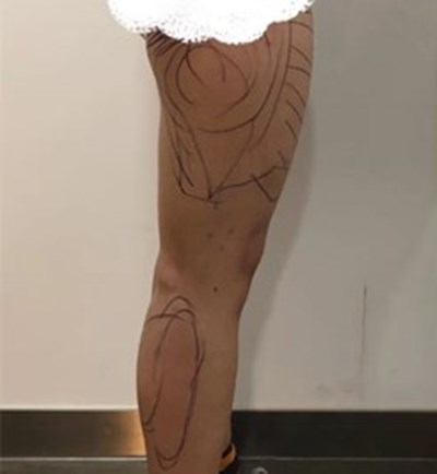 上海七家重磅吸脂醫(yī)院匯總，了解這些正規(guī)機構(gòu)！