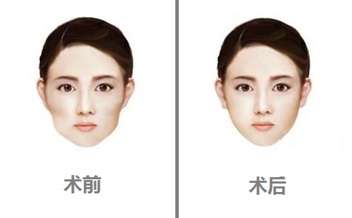 北京圣心整形醫(yī)院靠譜嗎？整形效果值得信賴(lài)嗎？