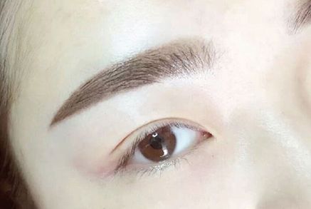 哈爾濱拉皮手術哪家醫(yī)院受歡迎，性價比高？