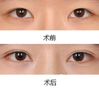長沙伊美醫(yī)療整形美容怎么樣？整形手術(shù)醫(yī)生的擅長項目有哪些？這家醫(yī)療機構(gòu)靠譜嗎？