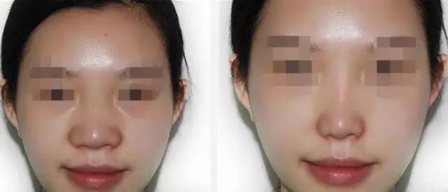南京靜態(tài)紋整形美容醫(yī)院哪家效果比較好？2023排行榜前10強(qiáng)一覽
