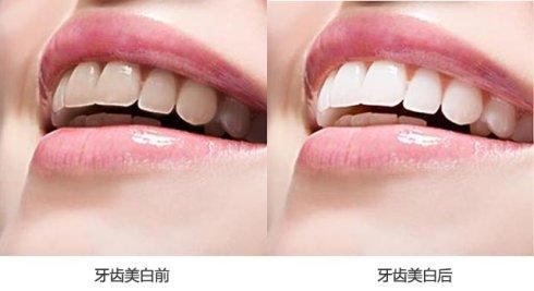 石家莊正規(guī)醫(yī)療整形美容醫(yī)院哪家面部吸脂加壓效果好？2023年醫(yī)院排行榜揭曉