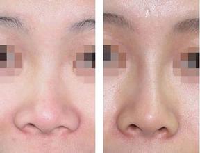 杭州乳房唇修復(fù)的醫(yī)院排名前十，專業(yè)且值得信賴！2023年權(quán)威評價揭曉！
