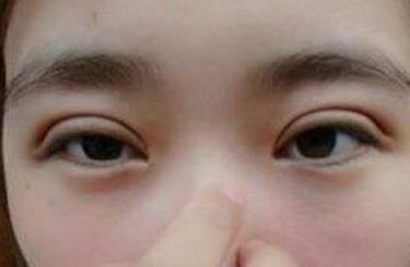 上海絕佳的醫(yī)療美容機構(gòu)出爐！揭秘2023年非常受歡迎的妊娠紋提拉手術(shù)醫(yī)院前十強！