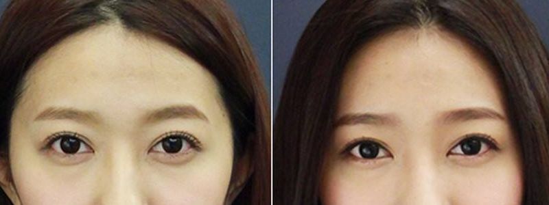 武漢民營整形醫(yī)院評選精選三強，硚口卓美、美基元、中翰實力強勁霸榜