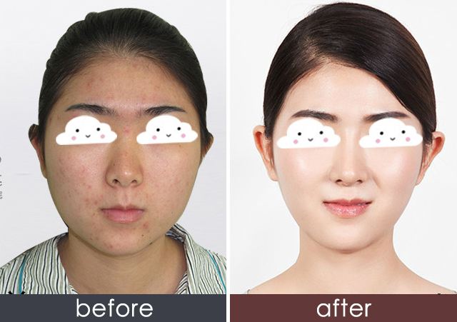 泉州抬頭紋醫(yī)院排行榜：2023年度權威Top10醫(yī)院揭曉！