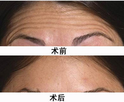 浙江紹興上虞人民醫(yī)院美容整形科的服務(wù)怎樣他們的價(jià)格表和收費(fèi)明細(xì)是什么