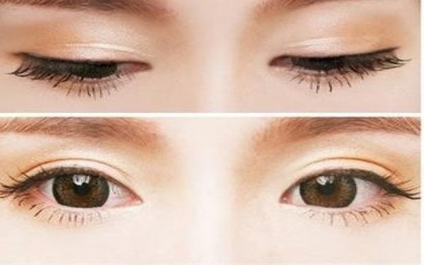 2023年鞍山哪些醫(yī)院是知名的祛痘印醫(yī)院排行榜前10？