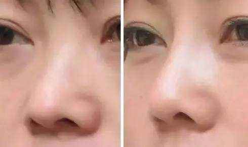 宜昌伊萊美美容整形醫(yī)院值得信賴嗎？醫(yī)術(shù)水平如何？