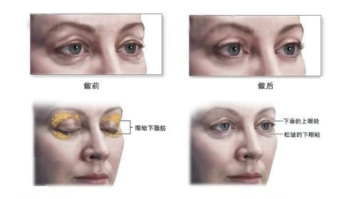 東莞美極整形醫(yī)院好不好？值得信賴嗎？