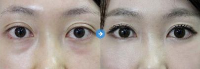 溫州地區(qū)鼻翼縮小整形醫(yī)院綜合評析！重點推薦7家排行榜醫(yī)院