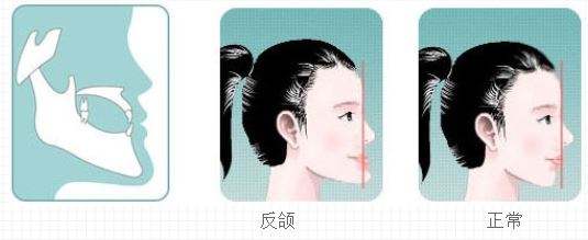 重慶口腔美容醫(yī)院排行榜：讓您的笑容更加美麗的最佳選擇！