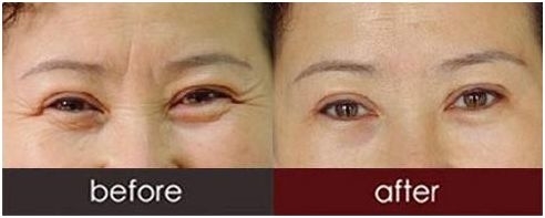 深圳乳房包塊切除哪家醫(yī)院實(shí)力出眾？排名前10強(qiáng)院所揭曉