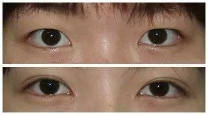 河南哪家醫(yī)院的微針祛痘印效果好排名前10？2023年值得參考的技術(shù)醫(yī)療整形醫(yī)院選項(xiàng)！