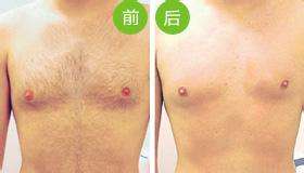 鄭州市中心醫(yī)院醫(yī)學(xué)美容科的技術(shù)到底可靠嗎？整形效果如何？