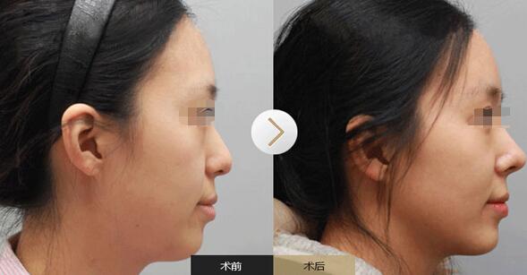 榆林整形界2023年醫(yī)院推薦：抗衰老除皺效果一流！深度揭秘：排行前10強(qiáng)醫(yī)療機(jī)構(gòu)