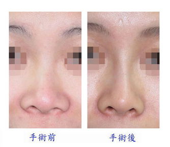 溫州疤痕修復(fù)權(quán)威醫(yī)院推薦：實(shí)力對(duì)比大揭秘