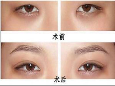 新疆整形美容醫(yī)院有口碑醫(yī)生嗎？你知道嗎？