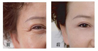 福州瘦臉針口碑美容醫(yī)院推薦 實力榜單TOP10