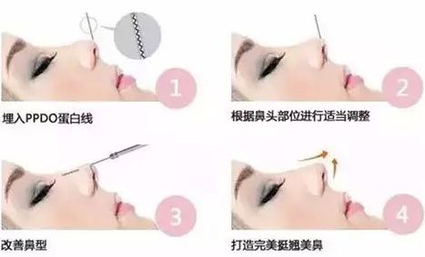 揭秘武漢最佳整形醫(yī)院：細數(shù)口碑最高的豐胸專家