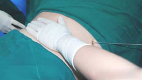 重慶專業(yè)去黑眼圈醫(yī)院排名大公開(kāi)！女生必看推薦名單！