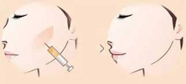 寧波豐臥蠶整形醫(yī)院口碑榜單揭秘