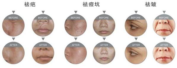 青島祛眼紋美容醫(yī)院排名推薦前十