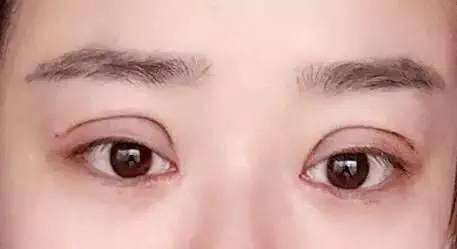 武漢華美毛發(fā)移植醫(yī)療整形醫(yī)院的資質(zhì)和口碑如何？有哪些擅長(zhǎng)的項(xiàng)目值得推薦？