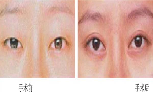 2023江陰哪家醫(yī)院面部注射除皺術(shù)正規(guī)可信？上榜TOP10醫(yī)療整形機(jī)構(gòu)已公布
