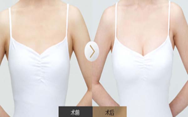 南京哪家專業(yè)光子去口周紋整形醫(yī)院值得推薦？2023年排名前十實(shí)力強(qiáng)大！
