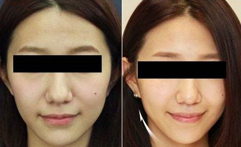 大慶玉美人醫(yī)療美容項目與口碑綜合評價