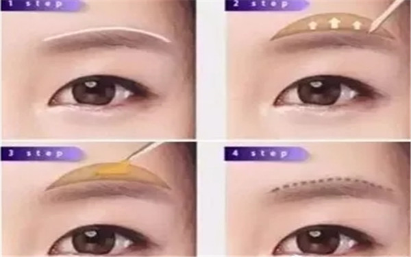 成都印第安紋注射醫(yī)療美容推薦榜前10名醫(yī)院有哪些？探尋2023年的選擇