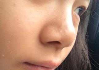 西安女子醫(yī)院整形科有哪些特色項目？整容效果如何呢？
