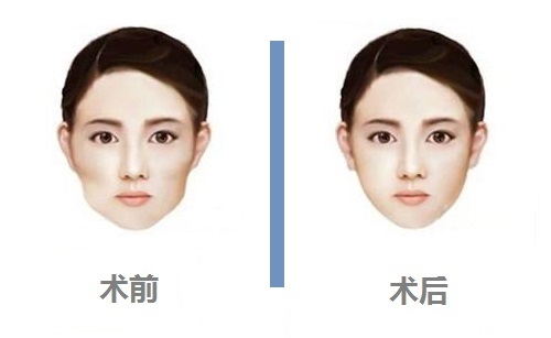 尋找長鼻矯正專業(yè)醫(yī)院？大連的朗域、科美如何選擇？