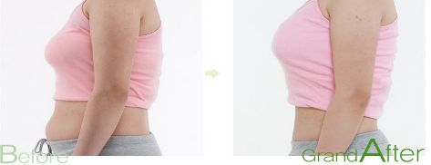 國內哪家下頜角整形醫(yī)院最受關注？推薦北京圣嘉新、上海華美等醫(yī)院