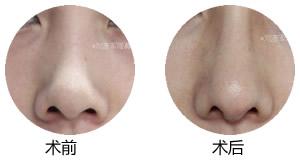 2023年北京最受關注的無創(chuàng)激光去胎記整形美容醫(yī)院排行榜前十強解析