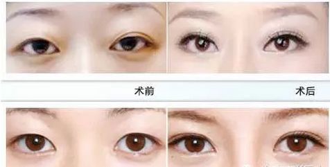 淮北喬雅登雅致玻尿酸整形美容醫(yī)院排名榜TOP10大揭秘！2023年比較有經驗的醫(yī)院是哪家？