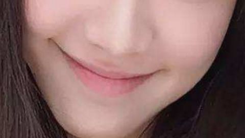 合肥藝星愛貝芙的打玻尿酸技術專業(yè)有資質嗎？