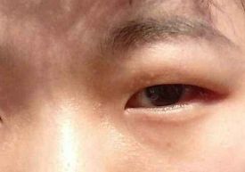 廣西減肥抽脂醫(yī)院哪家好？解讀頂級(jí)醫(yī)院獨(dú)特經(jīng)驗(yàn)，推薦您親測(cè)的專業(yè)權(quán)威機(jī)構(gòu)