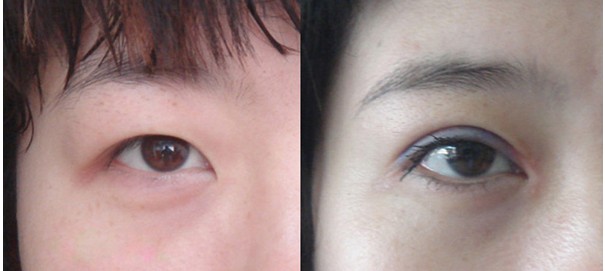 山東省千佛山醫(yī)院有哪些醫(yī)院資質(zhì)和專業(yè)醫(yī)生團隊？
