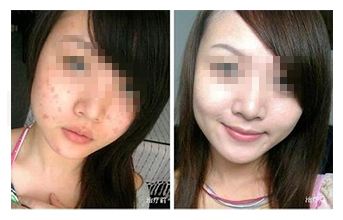 廈門療效顯著的水動(dòng)力抽脂瘦腰腹整形醫(yī)院推薦