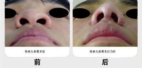 2023深圳治療痤瘡疤痕的整形醫(yī)院排行榜來(lái)啦！